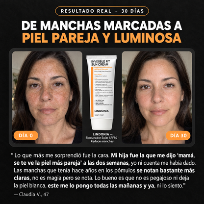 LINDONIA – Bloqueador Solar Anti-Manchas y Melasma SPF 50+