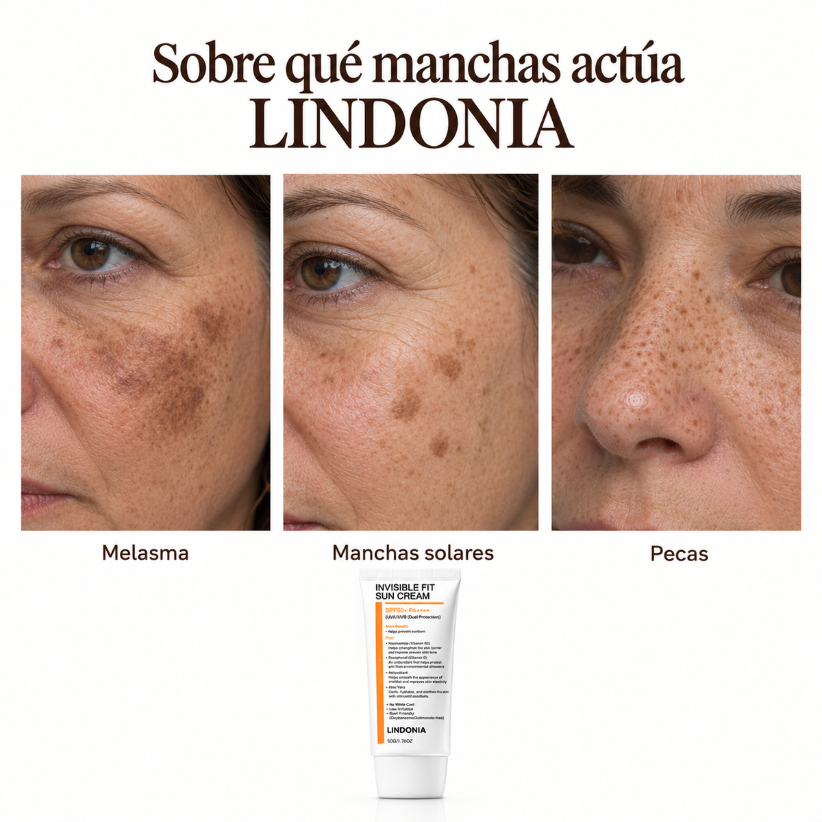 LINDONIA – Bloqueador Solar Anti-Manchas y Melasma SPF 50+