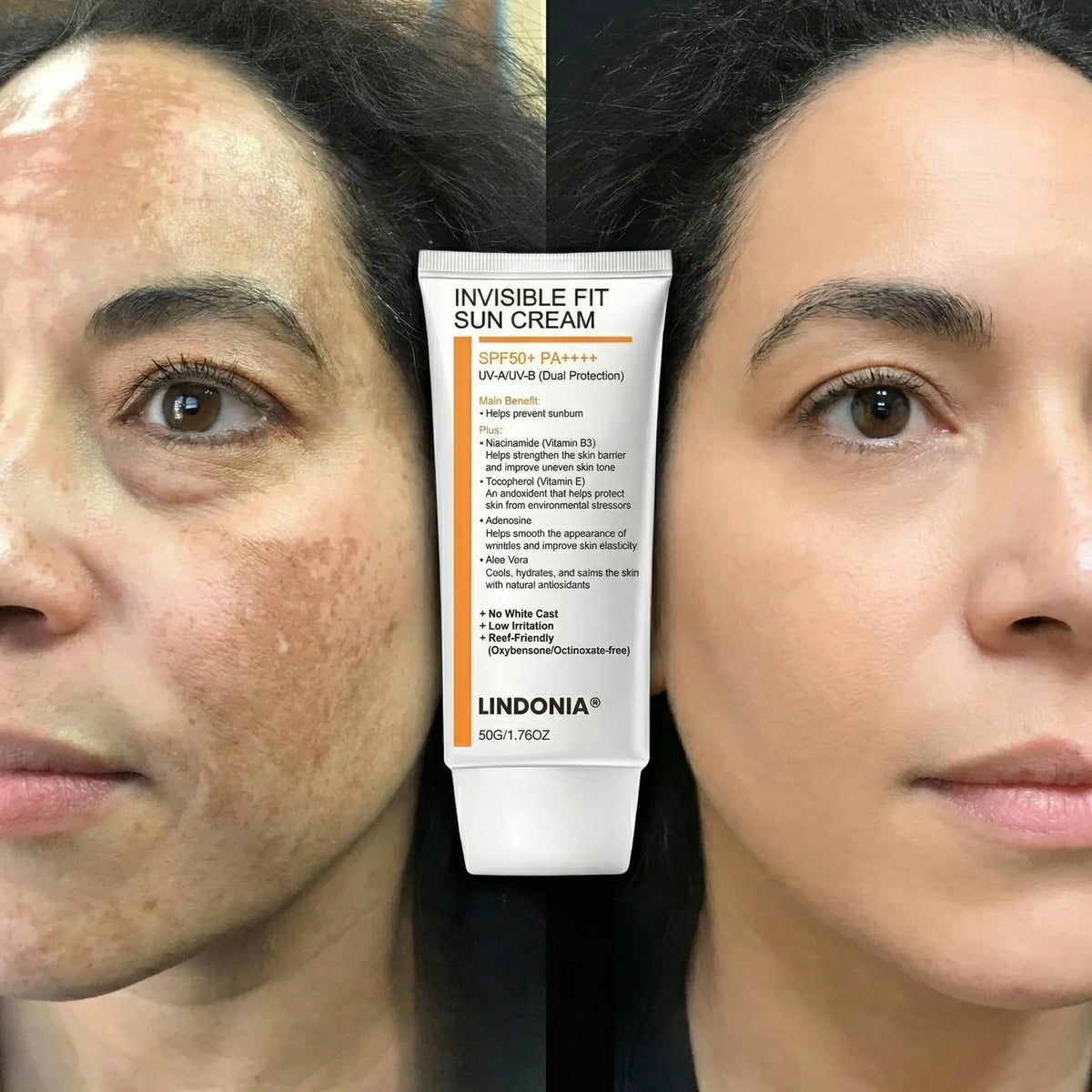 LINDONIA – Bloqueador Solar Anti-Manchas y Melasma SPF 50+